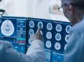 Here's how radiology imaging amplifies of medical diagnosis and treatment. Picture Shutterstock