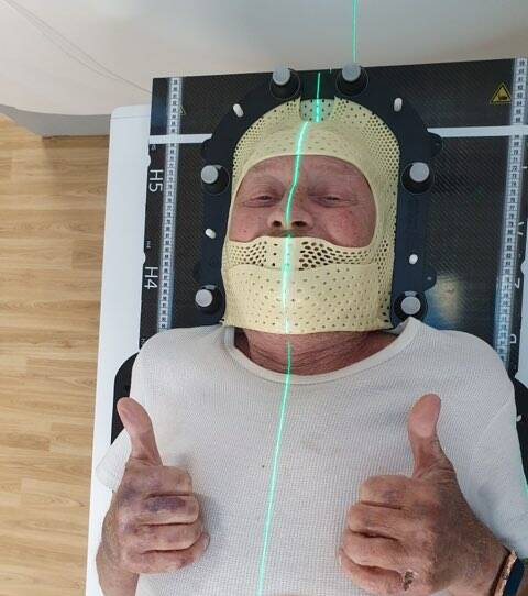 John Adams undergoing the new Varian HyperArc treatment at Orange Hospital. Picture supplied